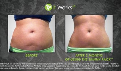 ItWorksGlobal Ultimate Body Applicator