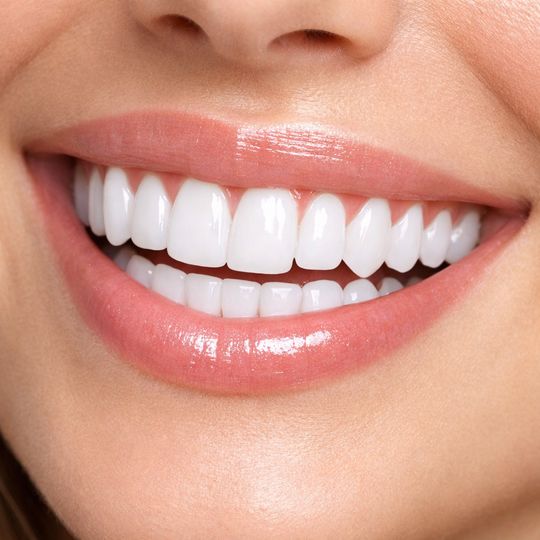 Vibrant Teeth whitening