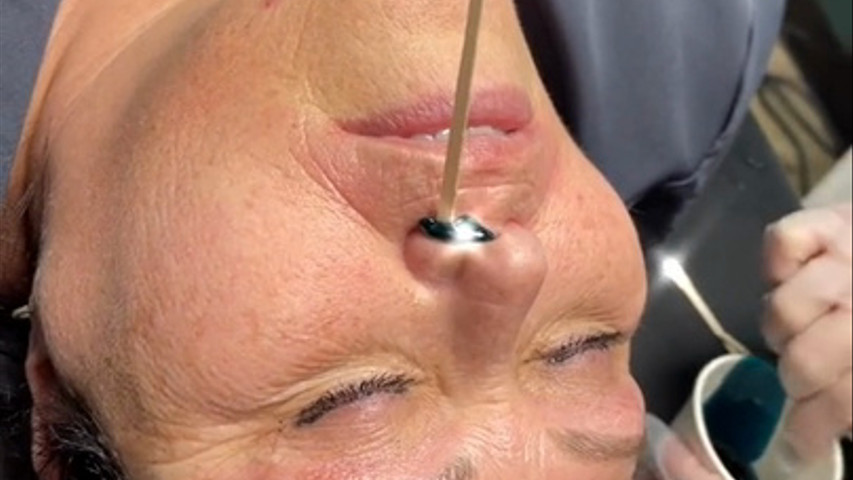 Waxing the Nose