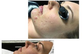 The J’SPOT Facial Club - 6