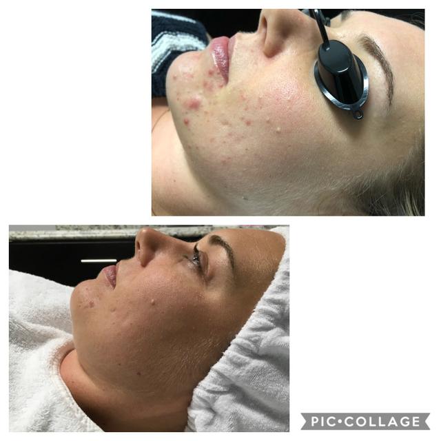 The J’SPOT Facial Club - 3