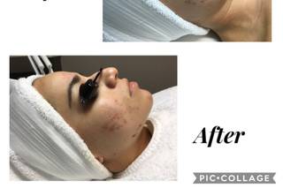 The J’SPOT Facial Club - 8