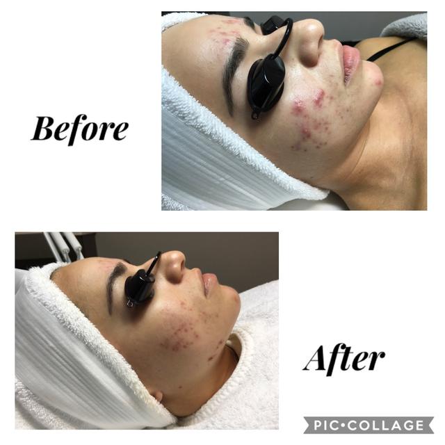 The J’SPOT Facial Club - 4