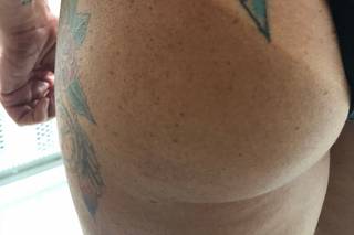 Skinn Sunless Tans - 5