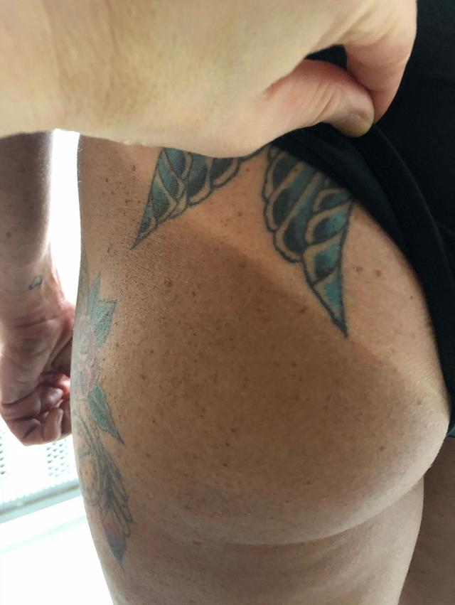 Skinn Sunless Tans - 2