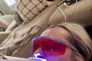 Illuma Teeth Whitening - 4