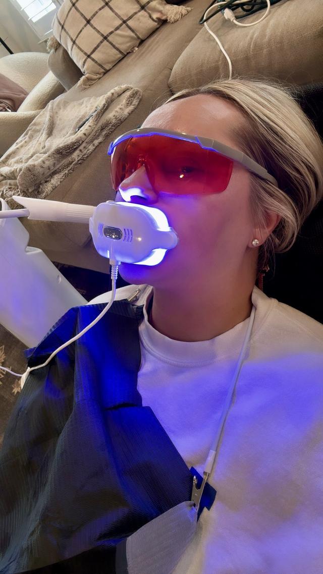 Illuma Teeth Whitening - 2
