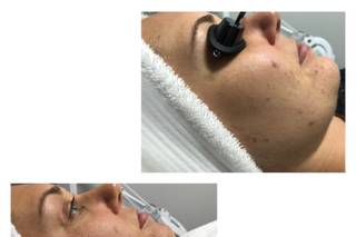 The J’SPOT Facial Club - 5