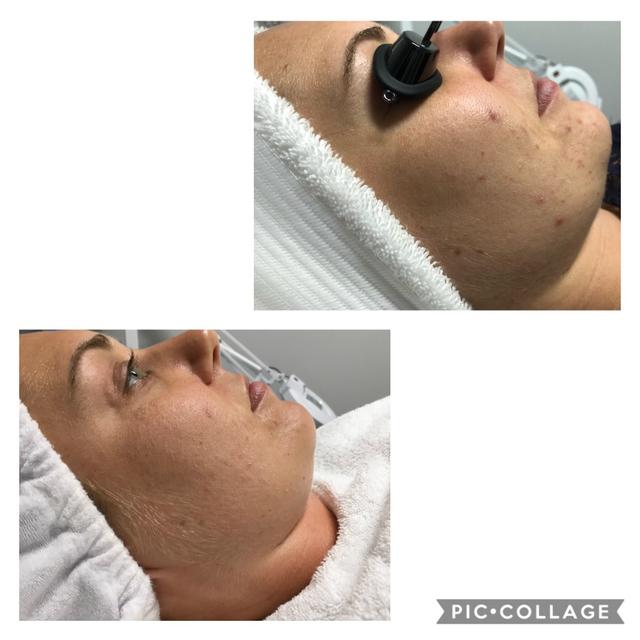 The J’SPOT Facial Club - 1