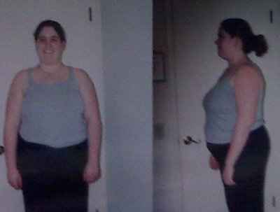 Major weight-loss body issue - Advice needed