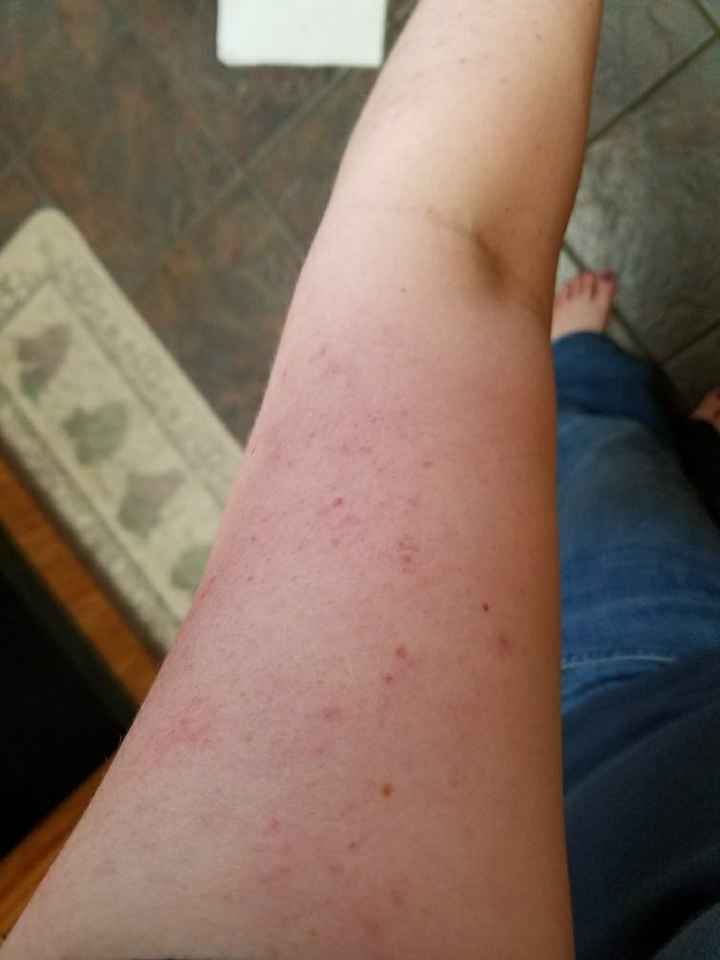 Makeup for Arms? - 1