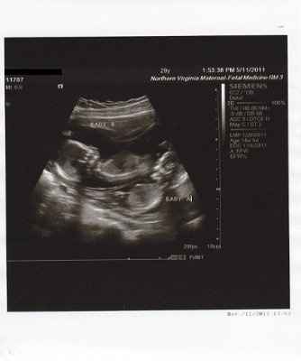 BR: 15 week belly pic and twin ultrasound