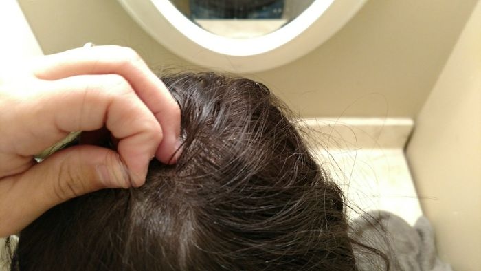 KWR: Hair DNA test