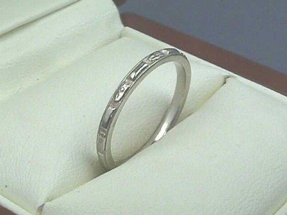 Would an art deco or other type of antique ring go with me ER? (PICS)