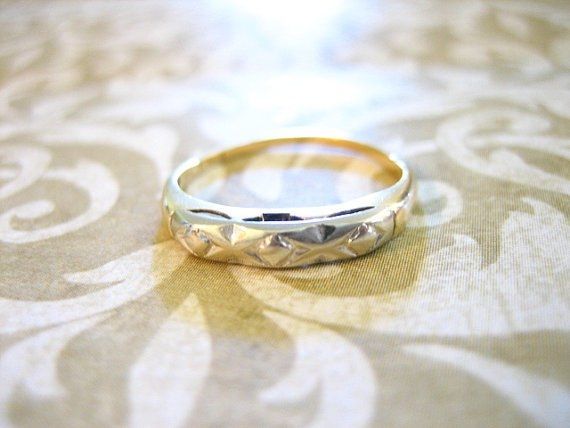 Would an art deco or other type of antique ring go with me ER? (PICS)