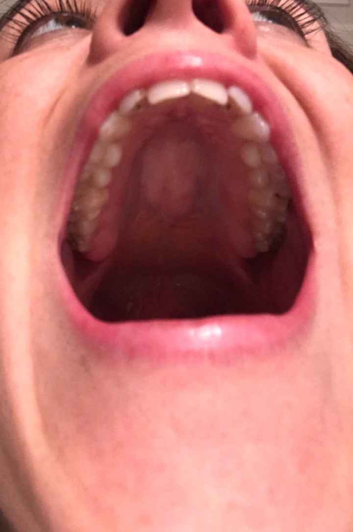 Teeth help - 2