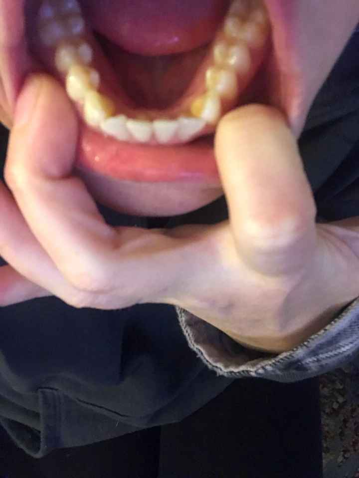 Teeth help - 3