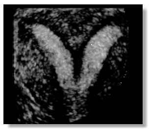 NWR; Check out my uterus!