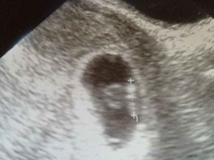 I have a secret ;-)