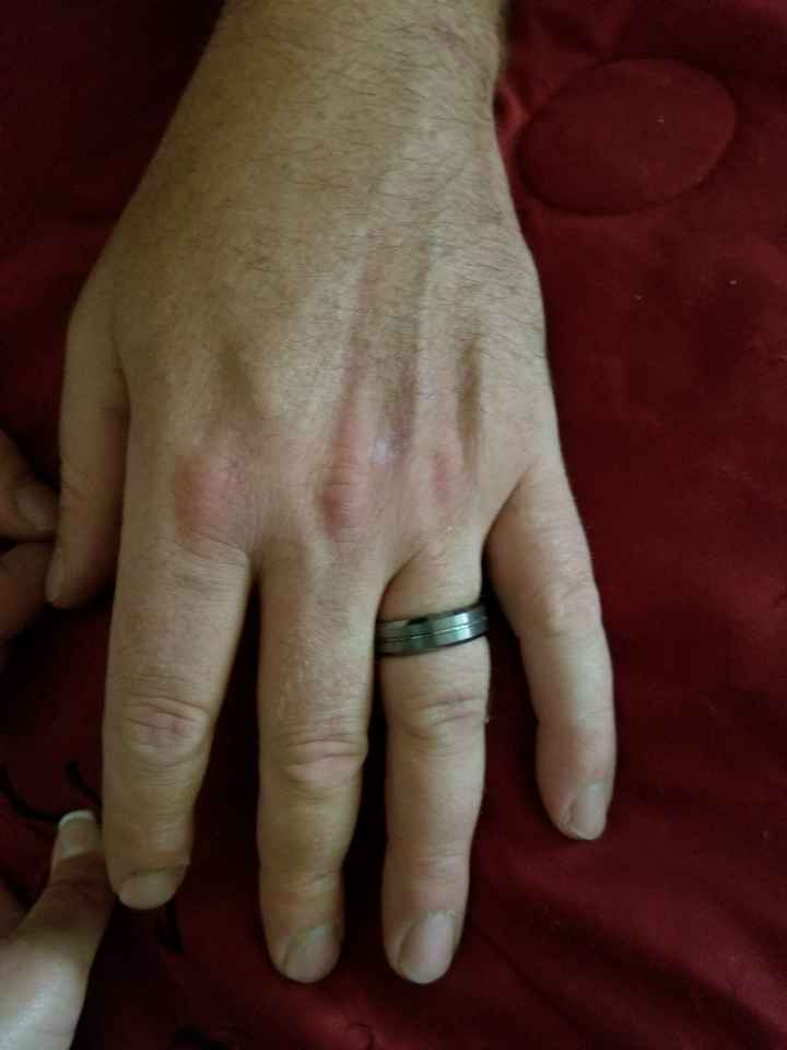 Picture 1 of my husbands wedding ring