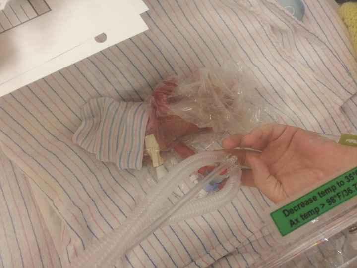 NWR- Please pray for this child