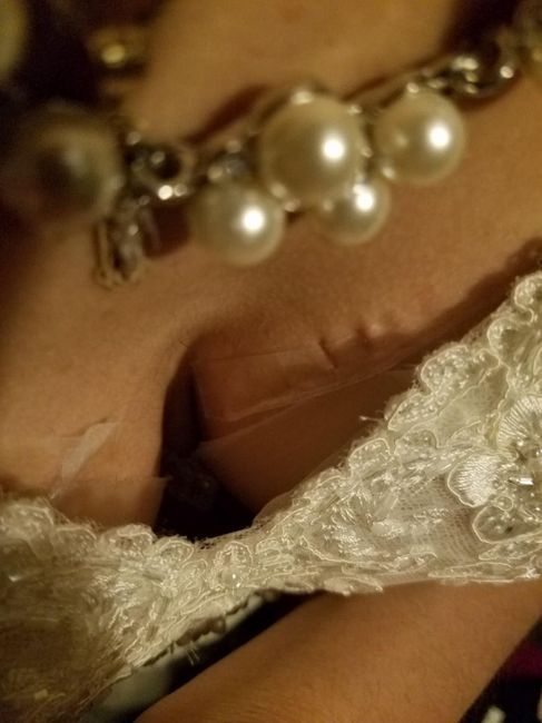 Need Help Asap! How do i fix the gap in my bust area?!?! 1