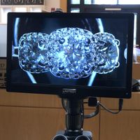 Engagement Ring Setting Remorse😩 - 1