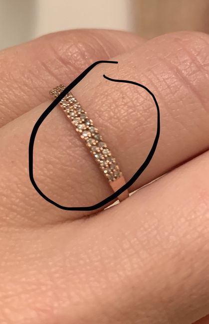 Wedding band issues - 1