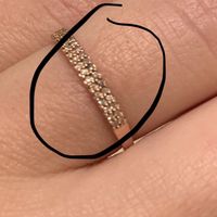 Wedding band issues - 1