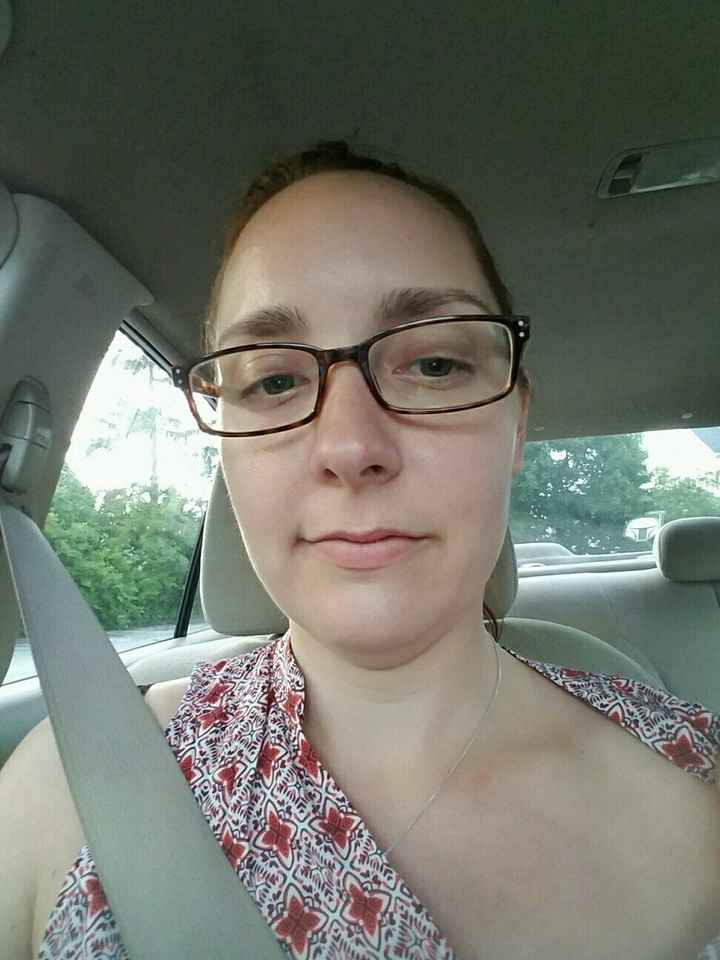 Sunburn 2 weeks before wedding?