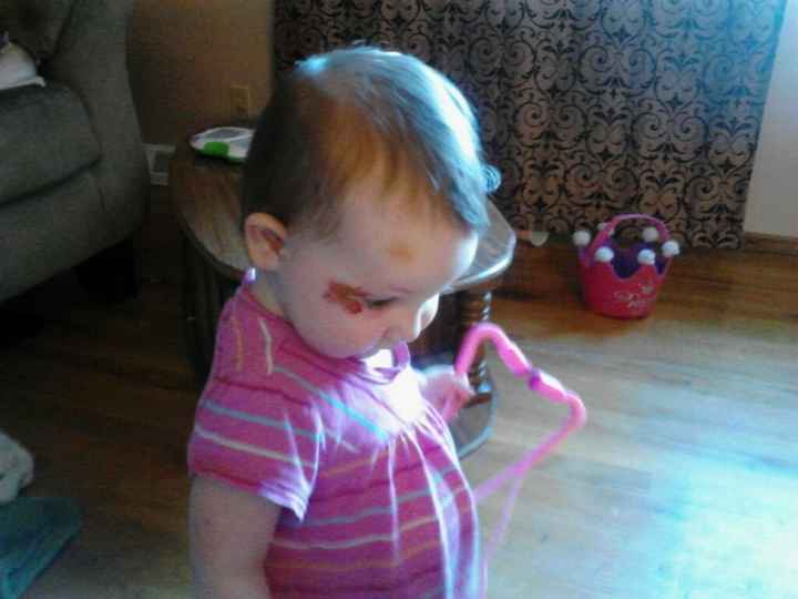 NWR (thank Goodness!!) guess who fell down the stairs!