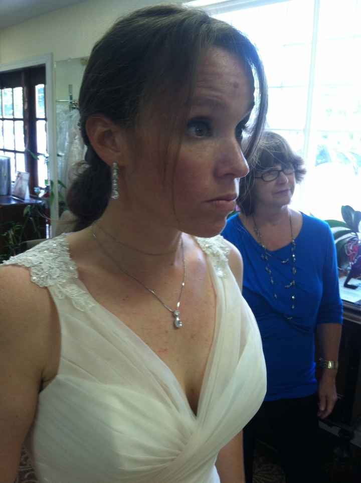 Minor plastic surgery before wedding? Advice please (gulp)?