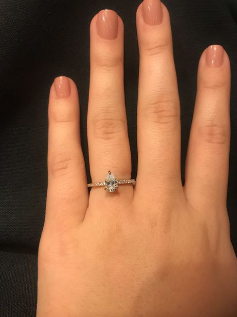 Wearing a ring 24/7? 1