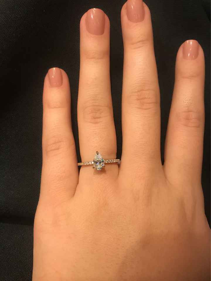 Wearing a ring 24/7? - 1