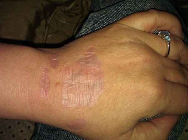 do you think I could pull this off with Gloves? *pics*