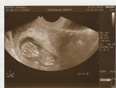 BR: monthly baby/pregnancy update thread!