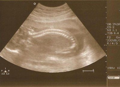 BR: Baby Potter is a......