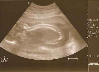 BR: Baby Potter is a......