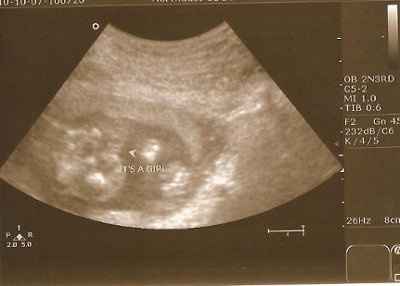 BR: Baby Potter is a......