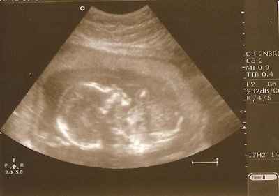 BR: Baby Potter is a......