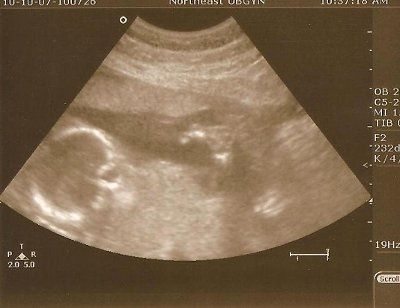 BR: Baby Potter is a......