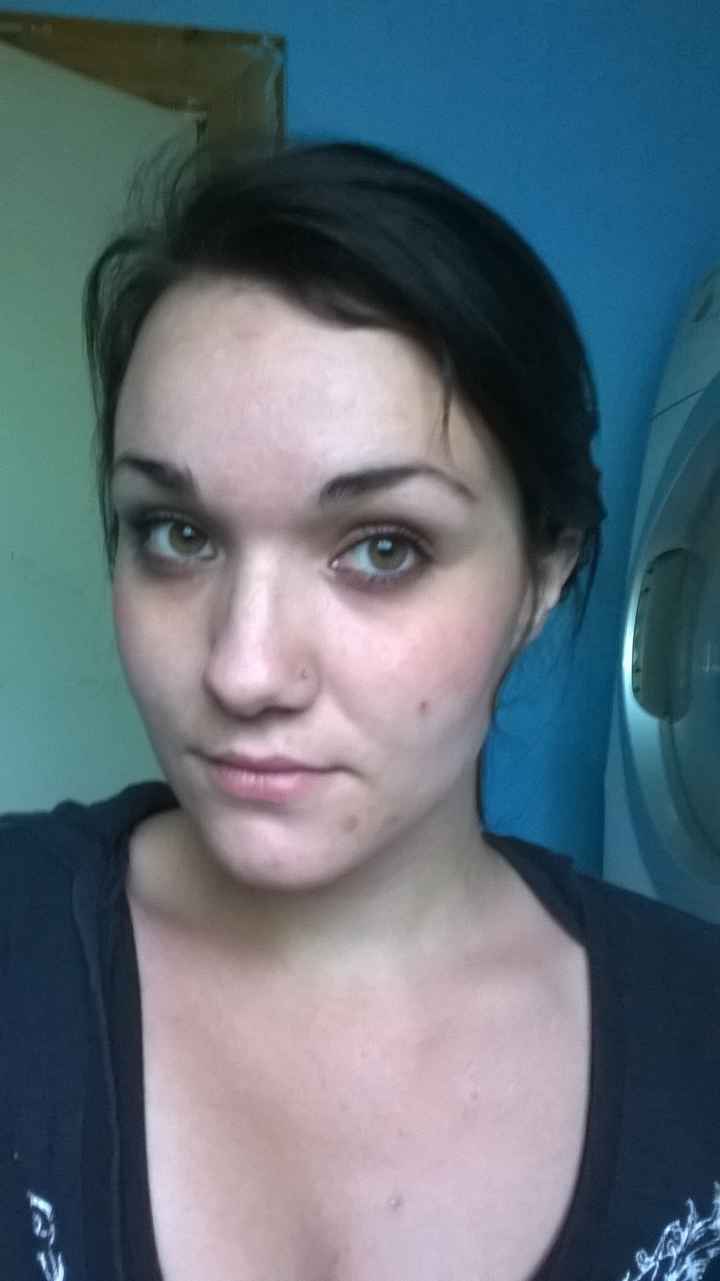 im worried about acne? advice?