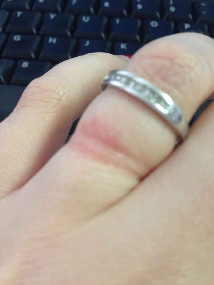 What is my ring doing to my finger and how can I stop it? : r/jewelry
