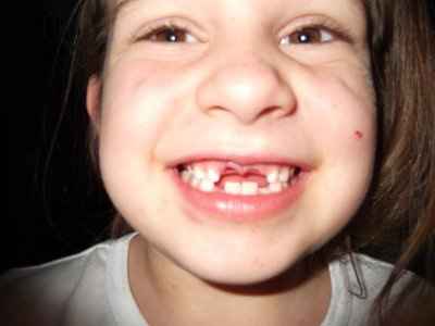 toothless flower girl :0)