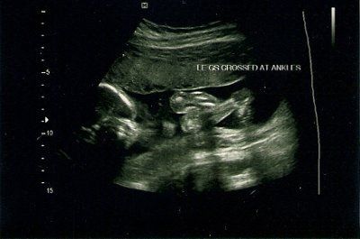 Show me your babies!