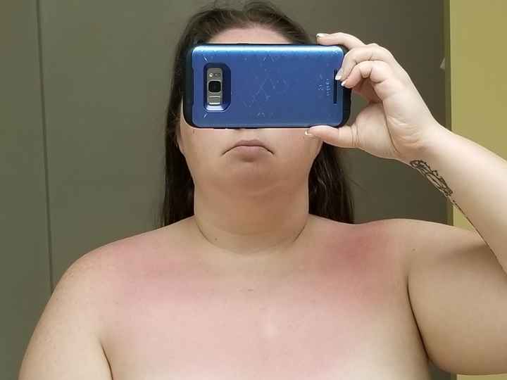 Wear sunscreen!! - 1