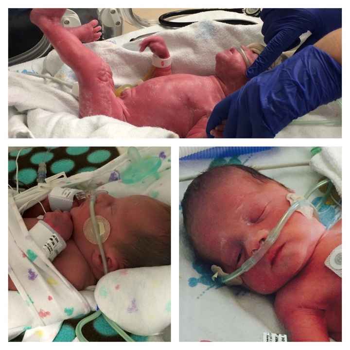 NWR: Positive thoughts needed (sister's pregnant)-UPDATE