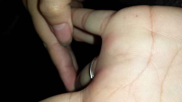 Do any of you feel that the back of your e-ring is really REALLY thin??  EDITED W/ PIC!!