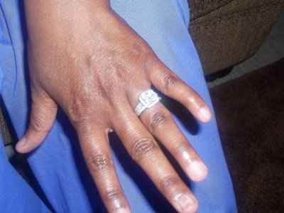 Show off your engagement ring!**Pics**