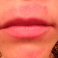 Allergic reaction/ paging make up gurus